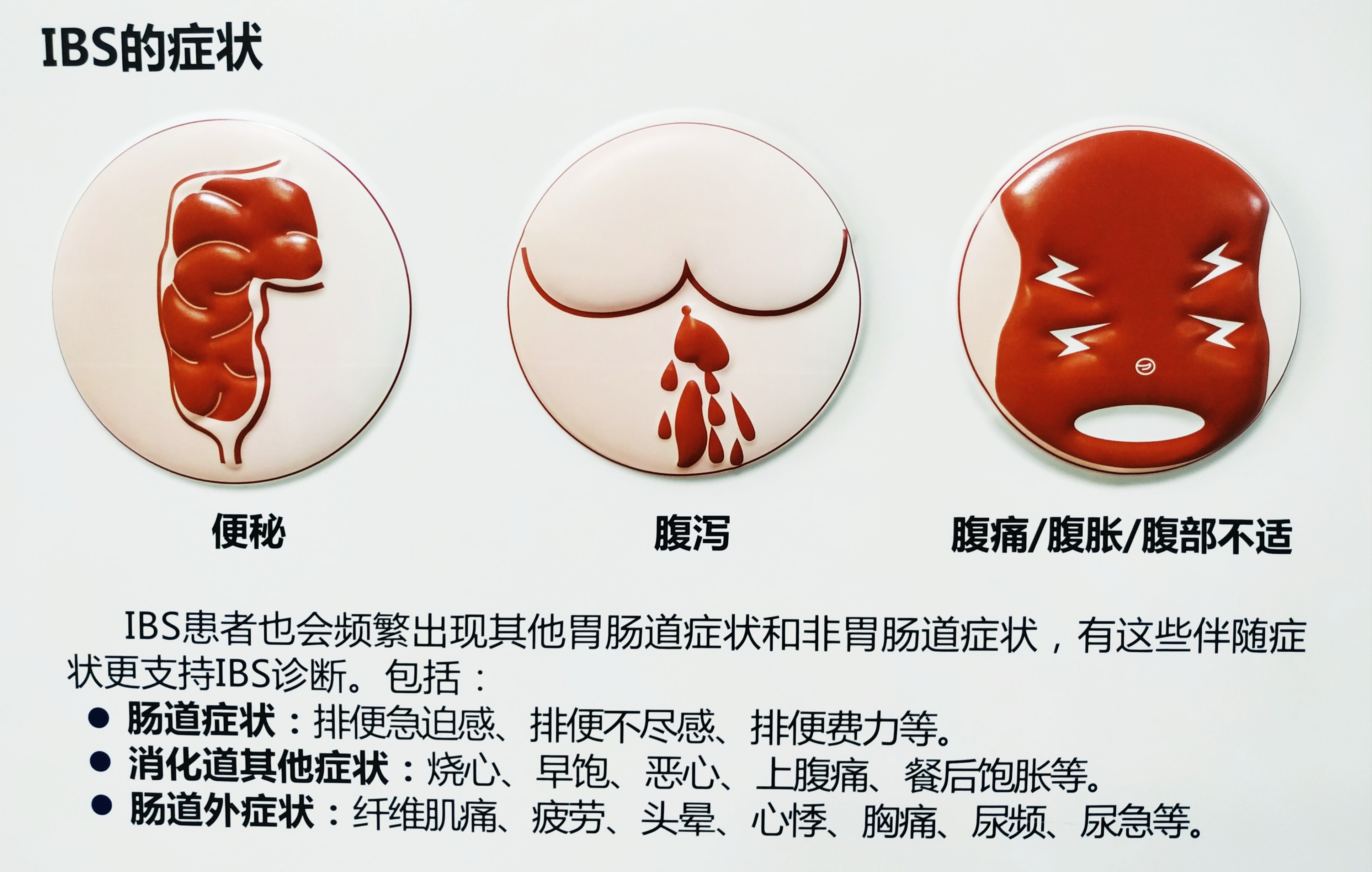 肠易激惹综合征（IBS）~病因篇_肠易激综合征_发病原因_症状表现- 好大夫在线