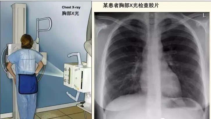 【影像科普】X 光检查：最经典的“拍片”